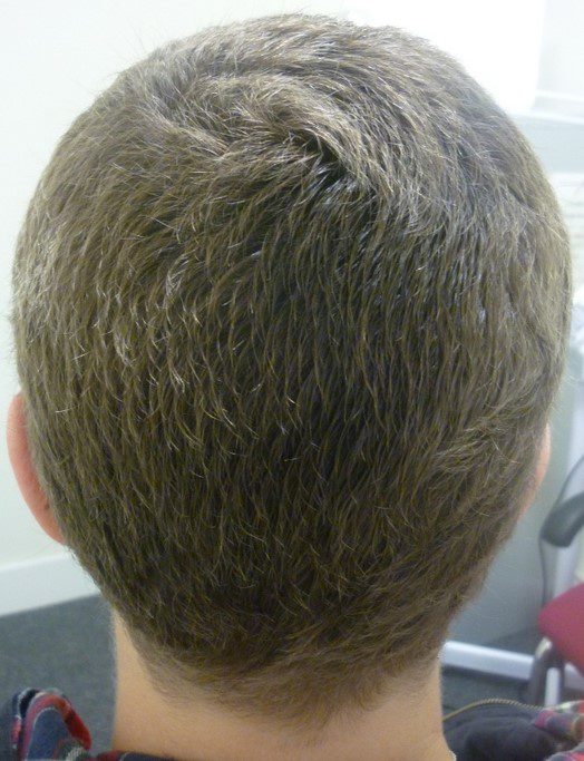 client 6 after